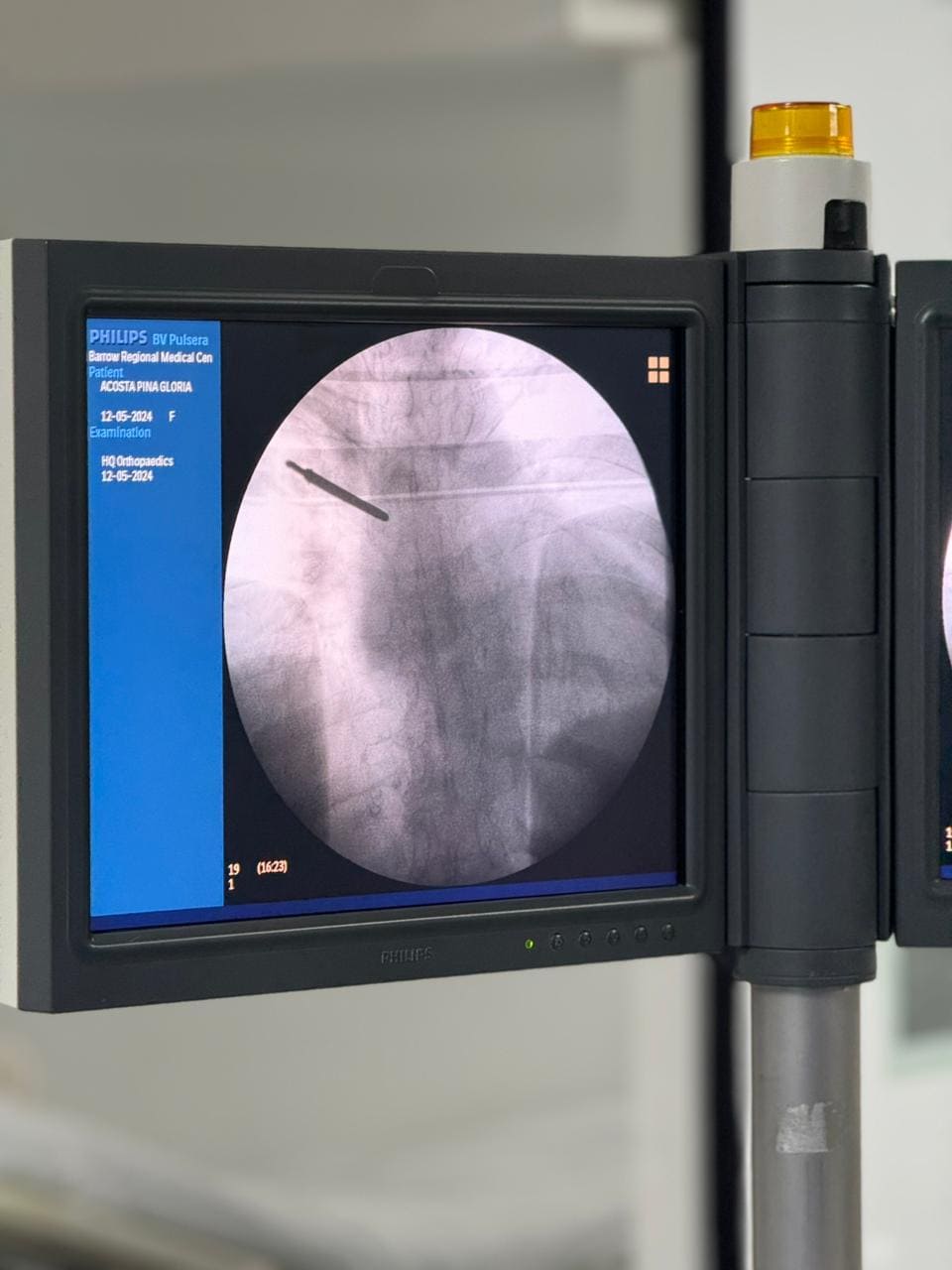  columna vertebral cervical